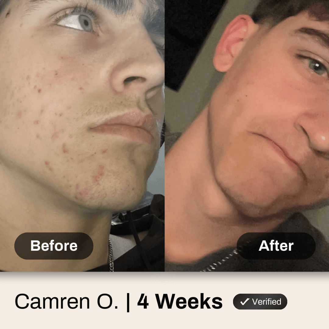 Face System