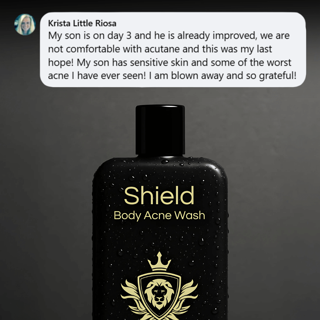 Shield Body Acne Wash