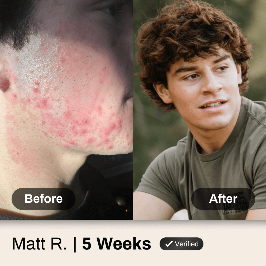 Advanced Face System