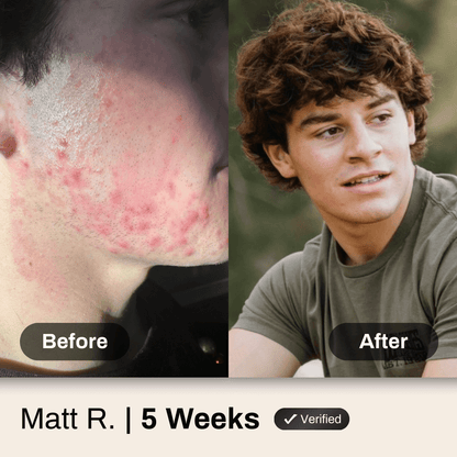 Advanced Face System