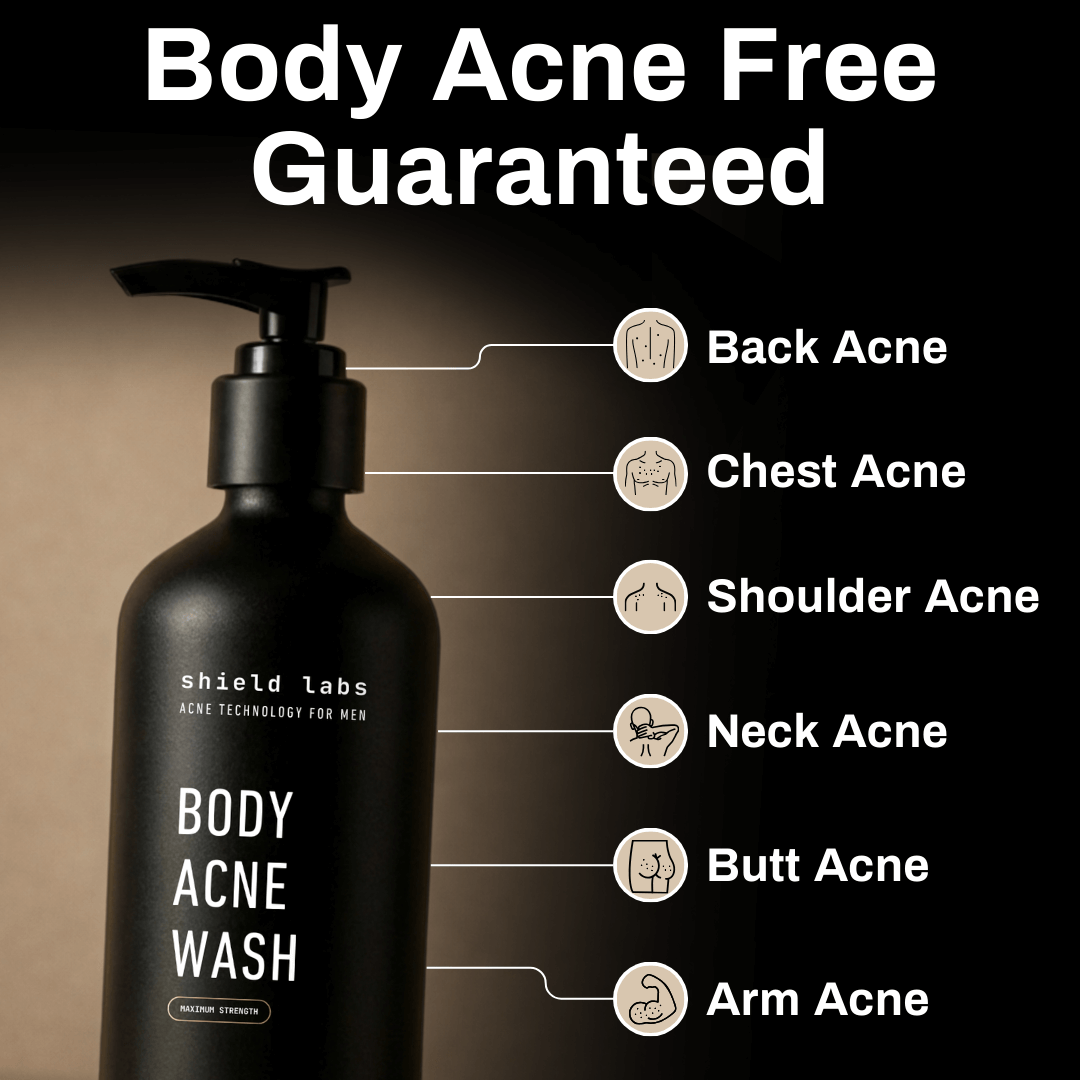 Body Acbe Body Acne Wash – Shield